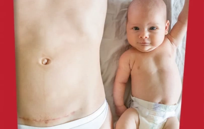 Zašto se zove carski rez - mama i beba